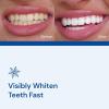 imageSNOW Diamond Teeth Whitening Strips  Gentle ampamp Enamel Safe White Strips for Teeth Whitening  atHome Dental Hygiene ampamp Tooth Care for a White Smile  Easy ampamp Convenient Tooth Whitening Strips  14 Ct42 Count Pack of 1