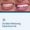 imageSNOW Diamond Wired Whitening Kit  Sensitive Teeth Whitening Kit  Whitens ampamp Repairs Teeth  6 Months of Whitening Treatment  Gentle ampamp Enamel Safe  BlueDiamond Wireless  1 Wand