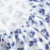 imageLaura Ashley  Queen Sheet Set Cotton Flannel Bedding Brushed for Extra Softness ampamp Comfort Evie Pink QueenEmelisa BlueWhite
